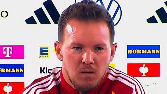 Nagelsmanndan Leroy Sane açıklaması Kendini kanıtlamak için fırsatı kalmadı