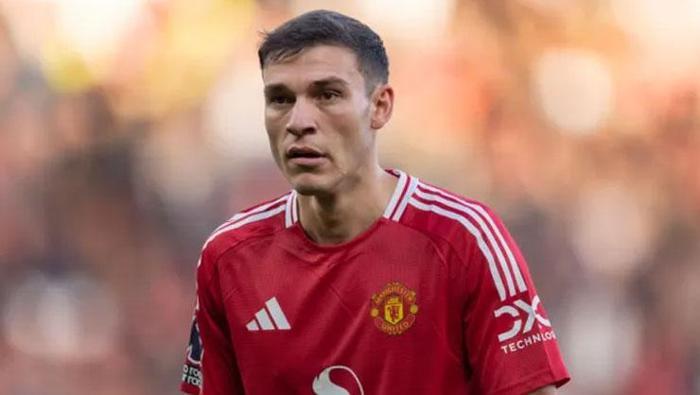 RUBEN AMORİM’DEN KESİK YEDİ