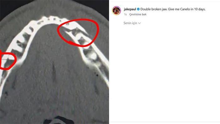 6. rauntta nakavt: Milyon dolarlık Jake Paul-Anthony Joshua maçının kazananı belli oldu