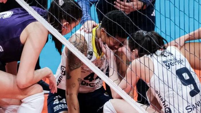 Melissa Vargastan sosyal medyaya düşen görüntüyle ilgili açıklama