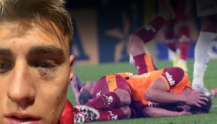 Kazımcan'a çakmak atan şahıs yakalandı