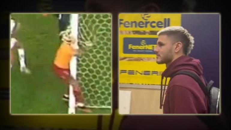 Galatasarayda Mauro Icardinin gözü morardı Maç sonunda ortaya çıktı