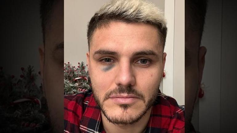 Mauro Icardi son anda engellendi Derbinin ardından...