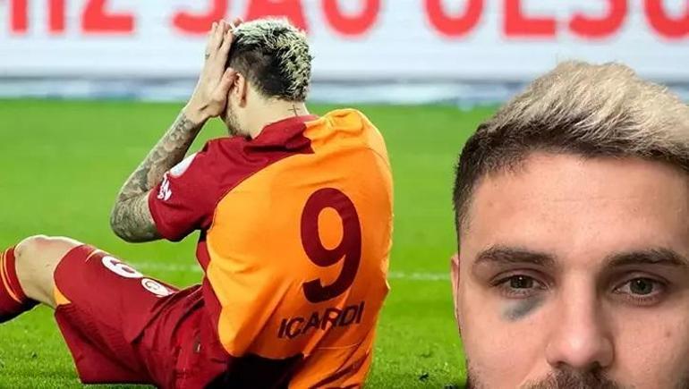 Galatasarayda Mauro Icardiden kötü haber Zaten eleştiriliyordu...