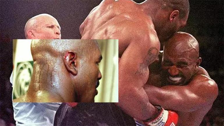 Mike Tyson maç sırasında fena yakalandı Isırma takıntım var