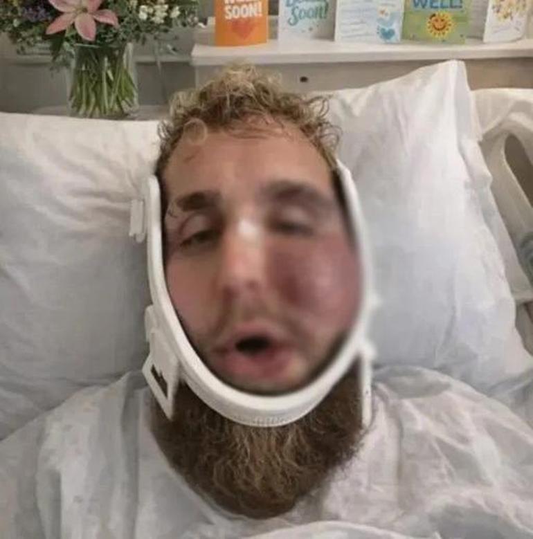 Çenesi kırıldı ama saniyede 93 bin dolar kazandı Jake Paulden son durumu için açıklama